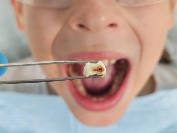 Best Pediatric Emergency Dentist in First Mesa, AZ